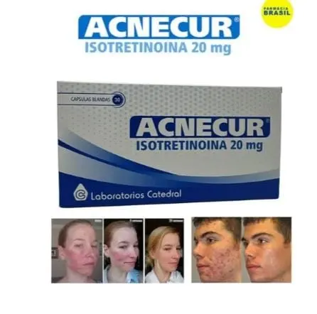 ACNECUR